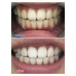 M渋谷 ホワイトニングのエステ・リラクイメージ