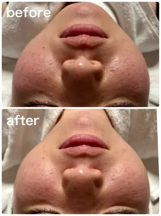 NONOKEKE ノノケケのエステ・リラクイメージ