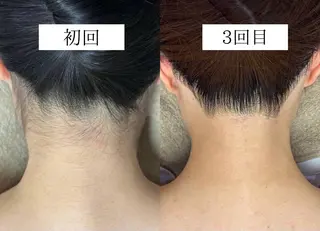 韓国美肌/肌質改善 【天神】のエステ・リラクイメージ