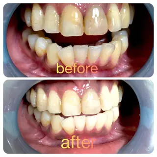 two nailのネイルデザイン