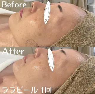 中目黒ハーブピーリン グ🌿ララピールのエステ・リラクイメージ