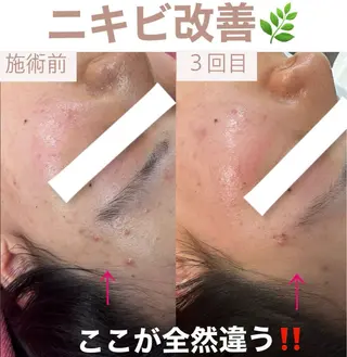 脱毛&美容サロン BLUESEAのエステ・リラクイメージ