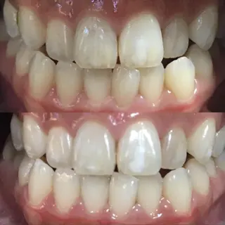 LBSホワイトニング 新宿店💎店長のエステ・リラクイメージ