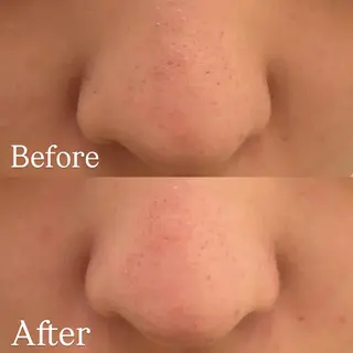 seika🍒 ハリラウンジ梅田のエステ・リラクイメージ