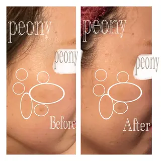 デトックス美容専門 サロンpeonyのエステ・リラクイメージ