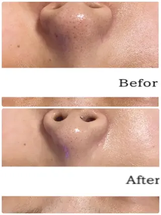 EYE LASH LAPISのエステ・リラクイメージ