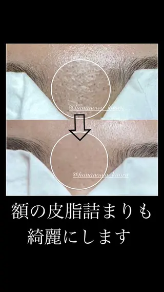 毛穴&リンパマッサー ジ専門サロン花のWAのエステ・リラクイメージ