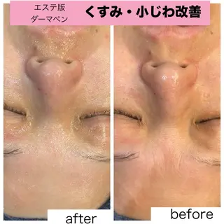 leolo武蔵浦和 肌質改善&脱毛のエステ・リラクイメージ
