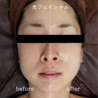 E LINDAのネイルデザイン