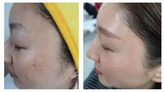 【小顔痩身専門看護師 サロンSONA】のエステ・リラクイメージ