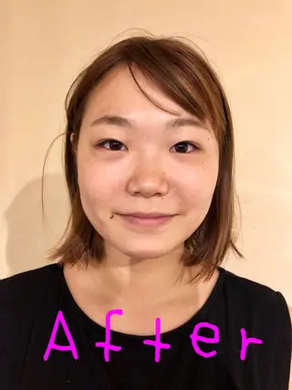 ヘッドスパ鍼/小顔鍼 EMS LINOAのエステ・リラクイメージ