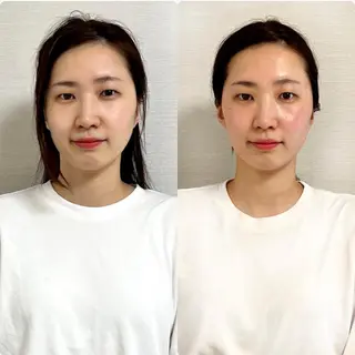 綺麗のひみつ グランプリ受賞店のエステ・リラクイメージ