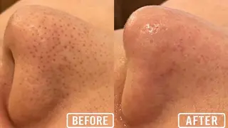 毛穴/毛穴洗浄専門 エミルカ船橋のエステ・リラクイメージ