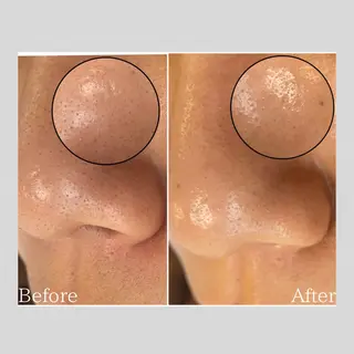 韓国肌管理 【毛穴専科】のエステ・リラクイメージ