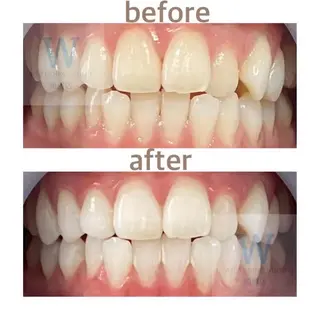 ホワイトニング ショップ船橋店🦷のエステ・リラクイメージ