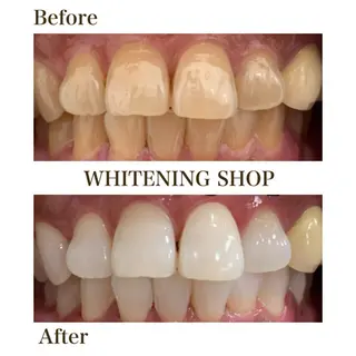 ホワイトニング ショップ葵区静岡駅店のその他イメージ