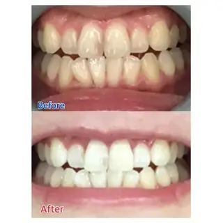 M渋谷 ホワイトニングのエステ・リラクイメージ