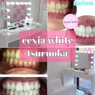 エクシアホワイトニング鶴岡店所属・ecxia鶴岡店 /さくらのその他イメージ