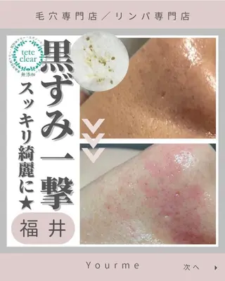毛穴肌質ケアサロン Yourmeユアミーのエステ・リラクイメージ
