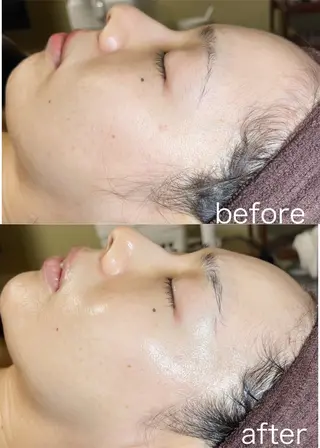 医療提携Beauty SalonMuseのエステ・リラクイメージ