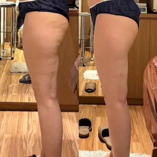 パルティール渋谷店所属・神宮司 はるかのエステ・リラクイメージ