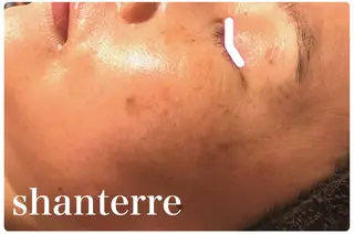 ピーリングサロン シャンテールのエステ・リラクイメージ