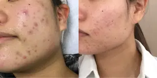 素肌美づくりサロン 《鴻巣・熊谷》のエステ・リラクイメージ