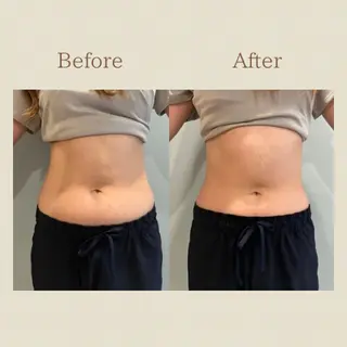 お腹痩せエステ Flat BELLY 恵比寿所属・【腸もみ/冷却痩身】 お腹エステ/恵比寿のエステ・リラクイメージ