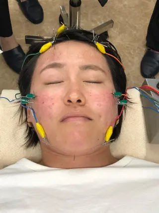小顔矯/美容鍼/鍼灸 BeauJuのその他イメージ