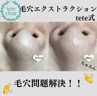 beauty salonWのエステ・リラクイメージ