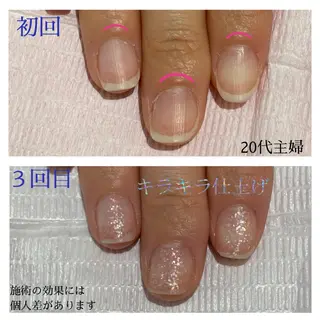 ネイル 自爪育成専門サロン エムロードゥ池下のネイルデザイン