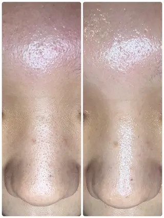 柳瀬 絵美のマツエク・マツパデザイン