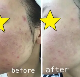 ulu. (ユール)のエステ・リラクイメージ