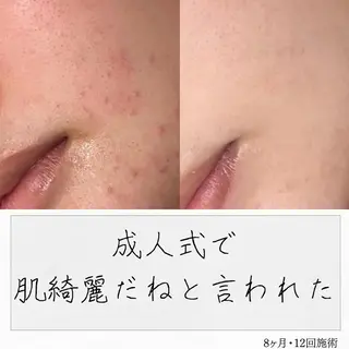 ニキビ経験者が施術 する専門サロン🌻のエステ・リラクイメージ