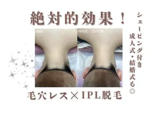 レイビス盛岡店 ♡吉田♡のエステ・リラクイメージ