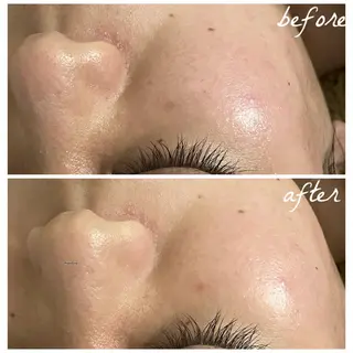 メンズ メナード岐阜市茜部 杉浦のエステ・リラクイメージ