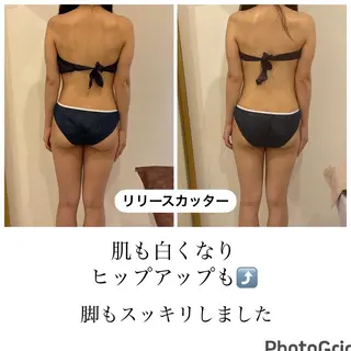 GLOW BOXのエステ・リラクイメージ