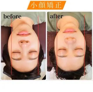 EXTR エクスターのエステ・リラクイメージ