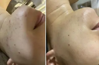 RAYVIS梅田店 HARUのエステ・リラクイメージ