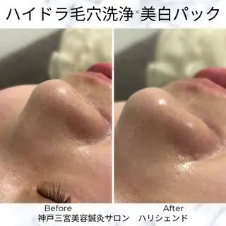 美容鍼・小顔矯正 ハリシェンドのエステ・リラクイメージ