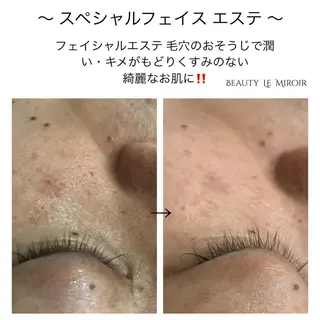 ビューティー ミロワールのエステ・リラクイメージ