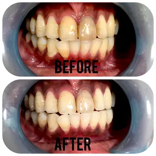 two nailのネイルデザイン