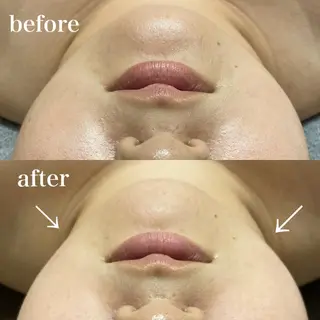 磐田｜LAYLA 一番丁寧な脱毛店のエステ・リラクイメージ