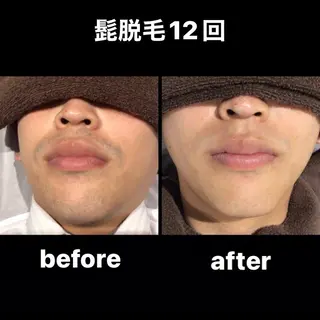 【都度払い制】　脱毛 ・エステ　Linoのエステ・リラクイメージ