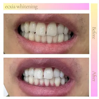 ecxia新白河店 ゆきのその他イメージ