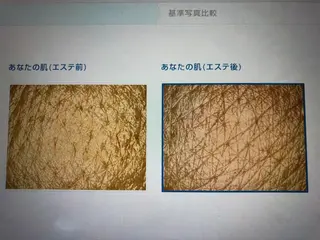 エステティシャン ちえりのエステ・リラクイメージ