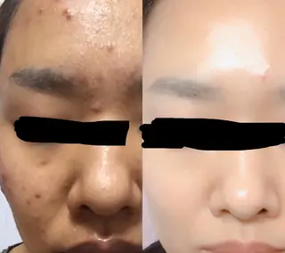 朝重い人専用 肩甲骨調整のエステ・リラクイメージ