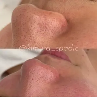 SPADIC中目黒所属・木村 ゆきのエステ・リラクイメージ