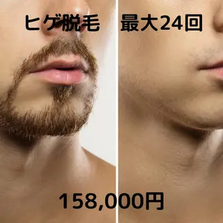 メンズ エピット横浜磯子店 大森のエステ・リラクイメージ