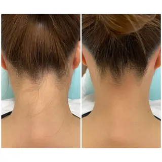 エステサロン Mi-mi.iのエステ・リラクイメージ